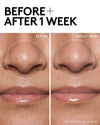 Detox N Tone Shine-Fighting Duo